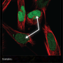 cell-to-cell_varialtions.png