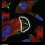 cytoskeleton_microtubule_ends.png