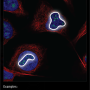 nucleoli_fibrillar_center.png